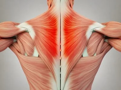 Cloud Nine Massage - Maplewood - Muscle Monday - Trapezius The most  superficial muscle in the upper back and one of the most common muscles  that people experience pain and tension in.